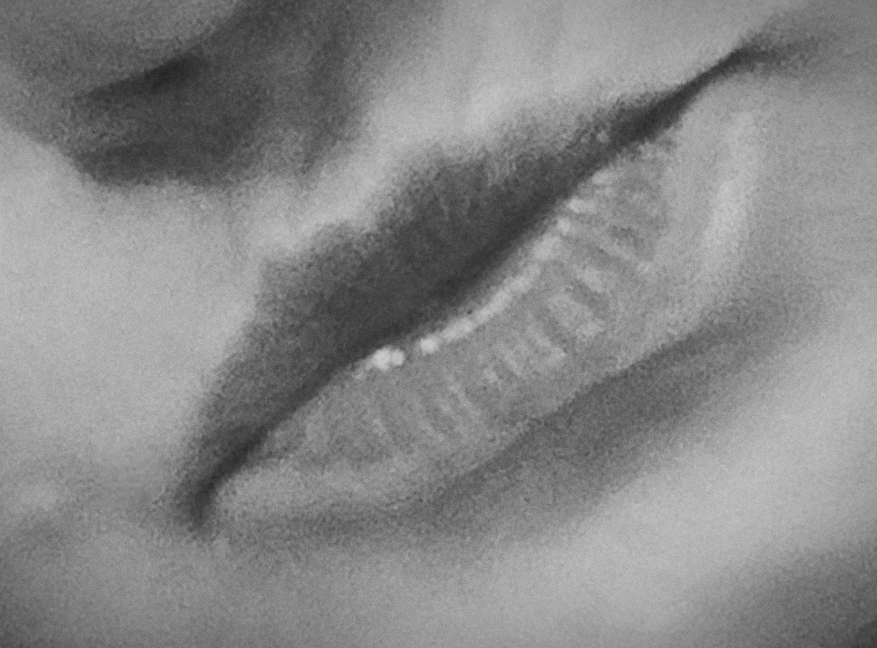 Kiss
